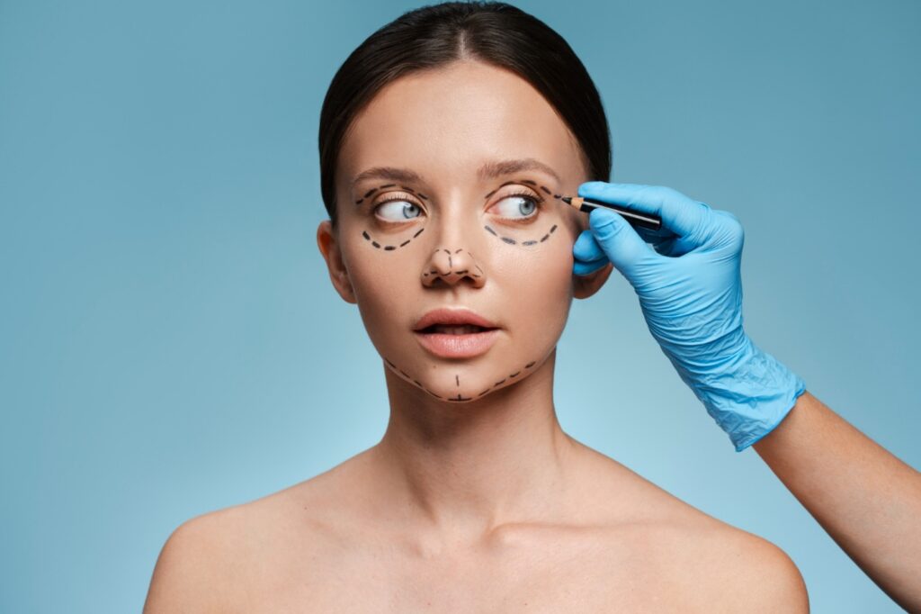 blépharoplastie